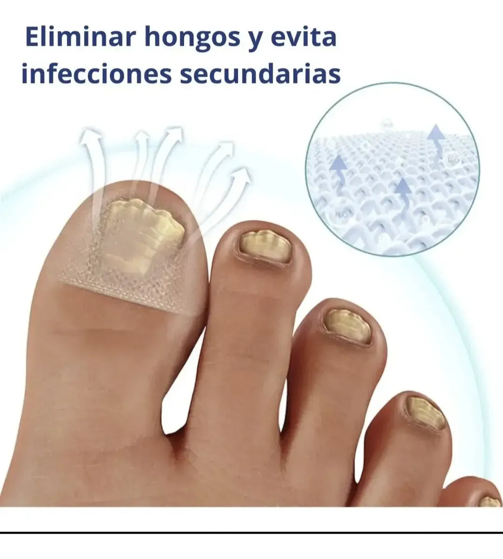 Parches AntiHongos 🩹 y Regeneradores De Uñas - FUNGAL NAIL PATCHES®💊